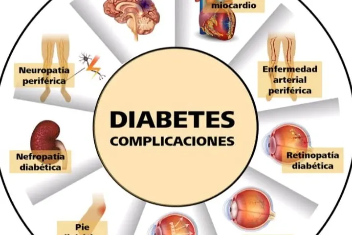 Complicaciones en la Diabetes